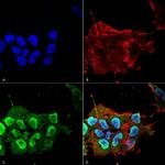 Ataxin 1 Antibody in Immunocytochemistry (ICC/IF)