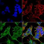 NMDAR2A Antibody in Immunocytochemistry (ICC/IF)