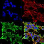 GluR1 Antibody in Immunocytochemistry (ICC/IF)