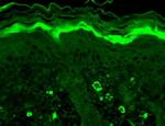 GABRB1 Antibody in Immunohistochemistry (Paraffin) (IHC (P))