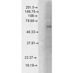 GABRB1 Antibody in Western Blot (WB)