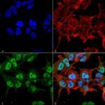 GABRA2 Antibody in Immunocytochemistry (ICC/IF)