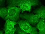 CACNB2 Antibody in Immunocytochemistry (ICC/IF)