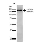 Ankyrin 1 Antibody in Western Blot (WB)