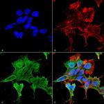 alpha-2c Adrenergic Receptor Antibody in Immunocytochemistry (ICC/IF)