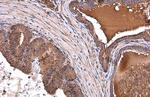 ALDH1A3 Antibody in Immunohistochemistry (Paraffin) (IHC (P))