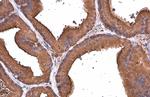 ALDH1A3 Antibody in Immunohistochemistry (Paraffin) (IHC (P))