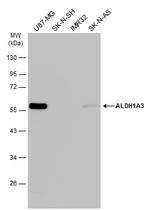 ALDH1A3 Antibody in Western Blot (WB)