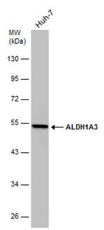 ALDH1A3 Antibody in Western Blot (WB)