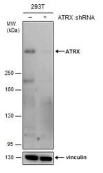 ATRX Antibody