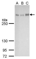 ATRX Antibody in Western Blot (WB)