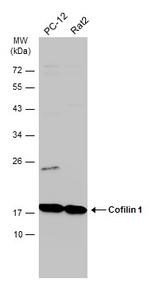 Cofilin Antibody in Western Blot (WB)