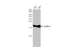 Cofilin Antibody in Western Blot (WB)