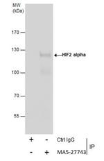 HIF-2 alpha Antibody in Immunoprecipitation (IP)