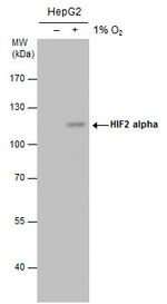 HIF-2 alpha Antibody in Western Blot (WB)