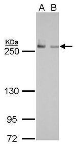 FASN Antibody in Western Blot (WB)