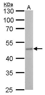 Fumarase Antibody in Western Blot (WB)