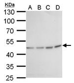 Fumarase Antibody in Western Blot (WB)