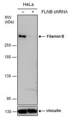 Filamin B Antibody