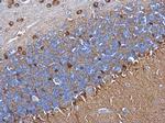 Glutamine Synthetase Antibody in Immunohistochemistry (Paraffin) (IHC (P))