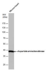 GOT1 Antibody in Western Blot (WB)