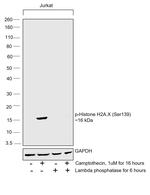 Phospho-Histone H2A.X (Ser139) Antibody