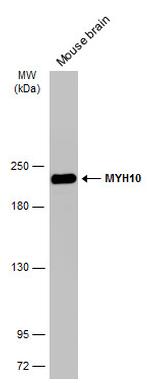 MYH10 Antibody in Western Blot (WB)