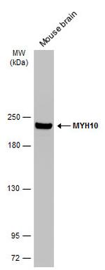 MYH10 Antibody in Western Blot (WB)