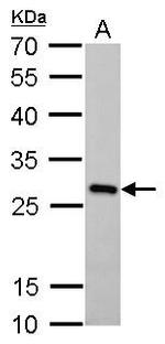 PGAM1 Antibody in Western Blot (WB)