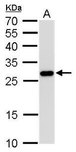 PGAM1 Antibody in Western Blot (WB)