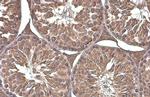 Phospho-Paxillin (Tyr118) Antibody in Immunohistochemistry (Paraffin) (IHC (P))