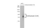 Phospho-Paxillin (Tyr118) Antibody in Western Blot (WB)