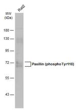 Phospho-Paxillin (Tyr118) Antibody in Western Blot (WB)