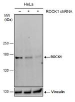 ROCK1 Antibody