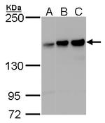 ROCK1 Antibody in Western Blot (WB)