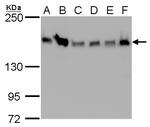 ROCK1 Antibody in Western Blot (WB)