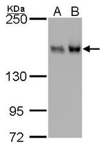 ROCK1 Antibody in Western Blot (WB)