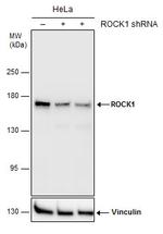 ROCK1 Antibody