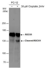 ROCK1 Antibody in Western Blot (WB)