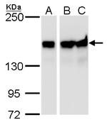 ROCK1 Antibody in Western Blot (WB)