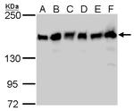 ROCK1 Antibody in Western Blot (WB)