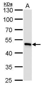 UQCRC1 Antibody in Western Blot (WB)