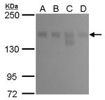 KDM6A Antibody in Western Blot (WB)