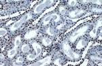 H4K16ac Antibody in Immunohistochemistry (Paraffin) (IHC (P))