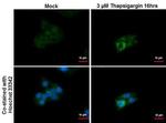 SQSTM1 Antibody in Immunocytochemistry (ICC/IF)