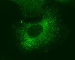 GEF-H1 Antibody in Immunocytochemistry (ICC/IF)