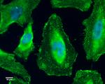 GEF-H1 Antibody in Immunocytochemistry (ICC/IF)