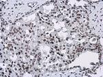 CFDP1 Antibody in Immunohistochemistry (Paraffin) (IHC (P))