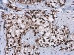 CFDP1 Antibody in Immunohistochemistry (Paraffin) (IHC (P))