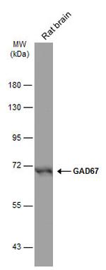 GAD67 Antibody in Western Blot (WB)